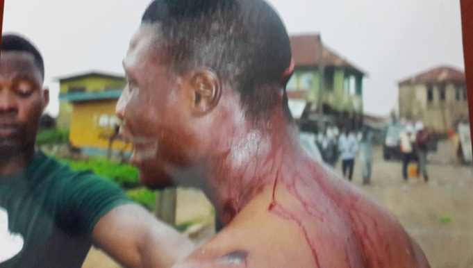 PDP-Thugs-Unleash-violence-on-innocent-victims-in-Ile-Ife