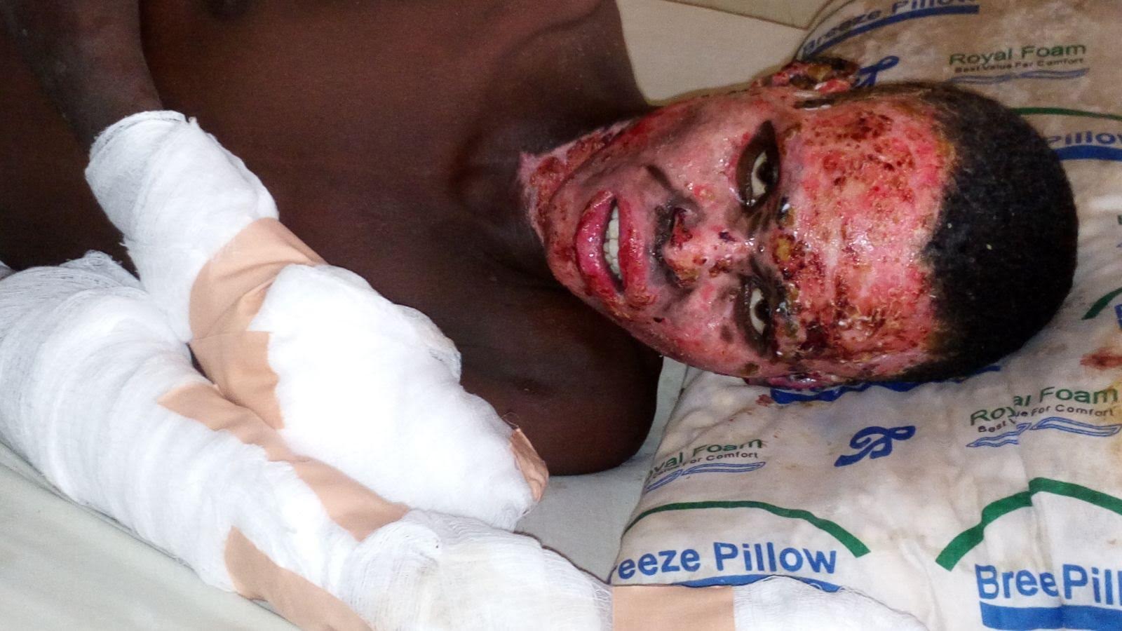 Vicim burned by army in Zaria massacre