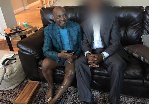 Former VP Namadina Sambo with remnant leg